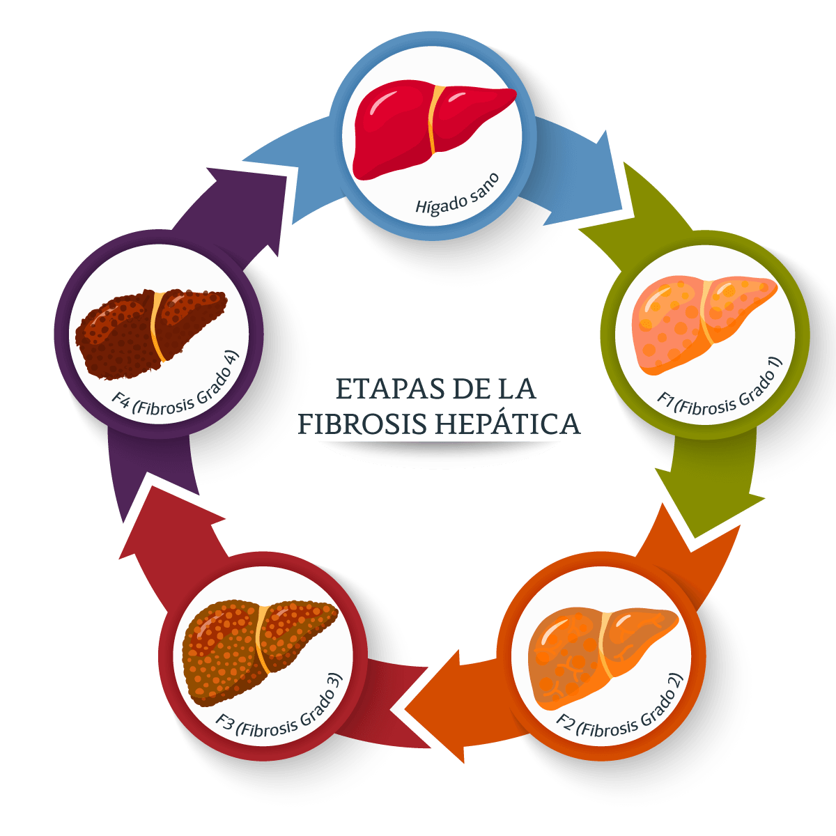 Gua de interpretacin de fibrosis heptica